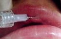 Diplomado en Rejuvenecimiento Facial en Odontoestomatología, Ozonoterapia y Tratamientos Combinados rejuvenecimiento