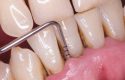 Postítulo de Especialidad Odontológica en Periodoncia imagen_periodoncia